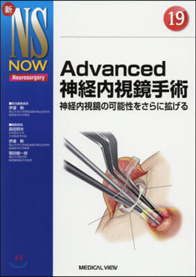 Advanced神經內視鏡手術 神經內視