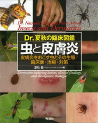 Dr.夏秋の臨床圖鑑 蟲による皮膚炎