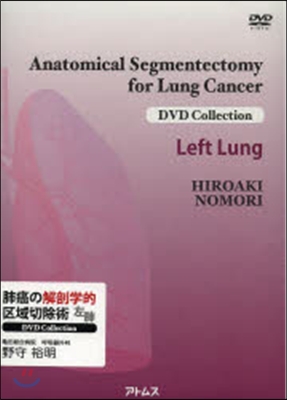肺癌の解剖學的區域切除術 左肺 DVD