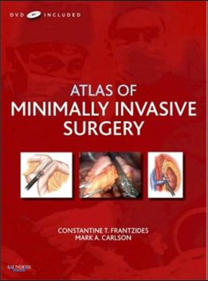 Atlas of Minimally Invasive Surgery