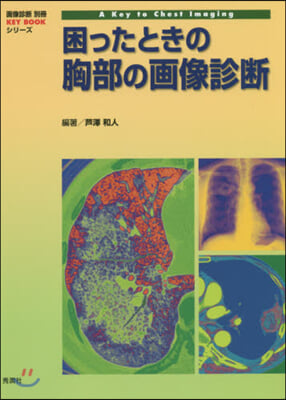 困ったときの胸部の畵像診斷