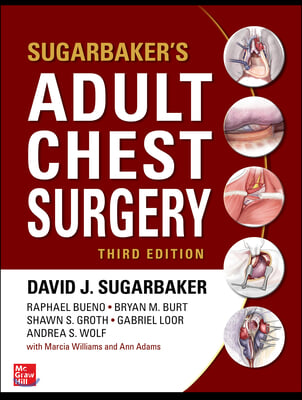 Sugarbaker&#39;s Adult Chest Surgery