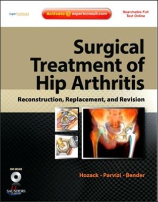 Surgical Treatment of Hip Arthritis