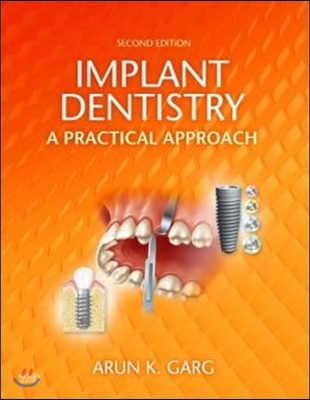 Implant Dentistry