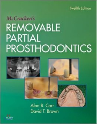 McCracken&#39;s Removable Partial Prosthodontics