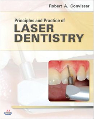 Principles and Practice of Laser Dentistry