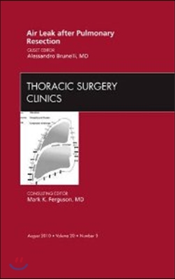 Air Leak After Pulmonary Resection, an Issue of Thoracic Surgery Clinics: Volume 20-3
