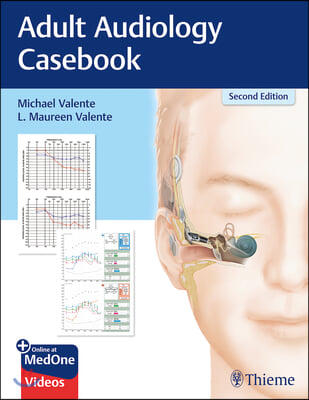 Adult Audiology Casebook