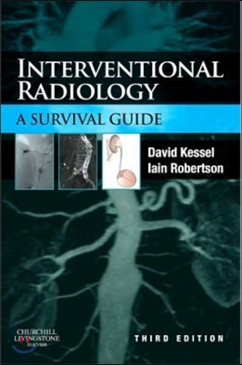 Interventional Radiology: A Survival Guide