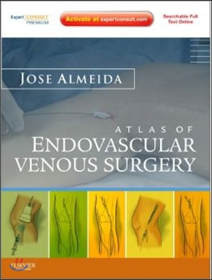 Atlas of Endovascular Venous Surgery