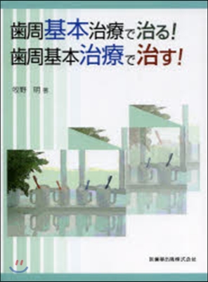 齒周基本治療で治る!齒周基本治療で治す!