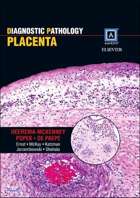 Placenta