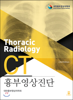 흉부 영상진단 CT