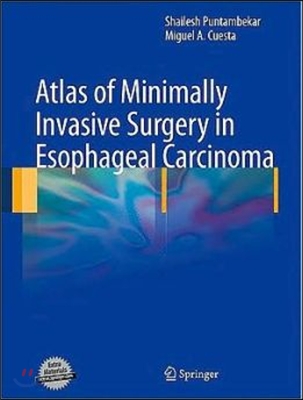 Atlas of Minimally Invasive Surgery in Esophageal Carcinoma