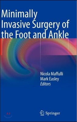 Minimally Invasive Surgery of the Foot and Ankle