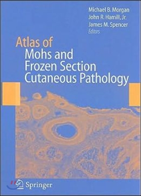 Atlas of Mohs and Frozen Section Cutaneous Pathology