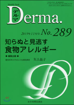 知らぬと見逃す食物アレルギ-