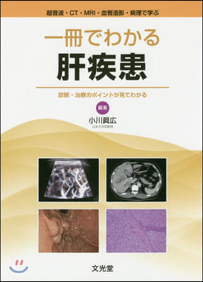 一冊でわかる肝疾患 診斷.治療のポイント