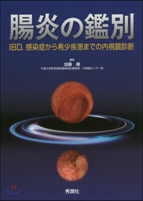 腸炎の鑑別 IBD，感染症から希少疾患ま