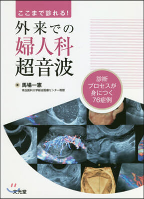 ここまで診れる!外來での婦人科超音波