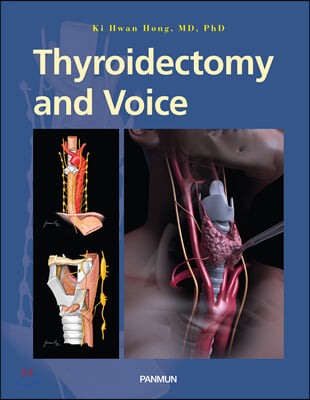 Thyroidectomy and Voice