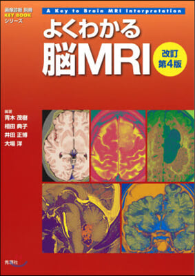 よくわかる腦MRI 改訂第4版