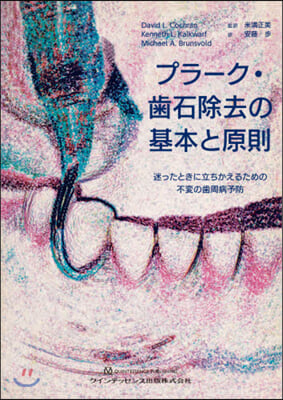 プラ-ク.齒石除去の基本と原則 迷ったと