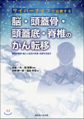 腦.頭蓋骨.頭蓋底.脊椎のがん轉移