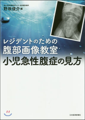 小兒急性腹症の見方