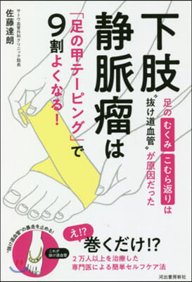 下肢靜脈瘤は「足の甲テ-ピング」で9割よ