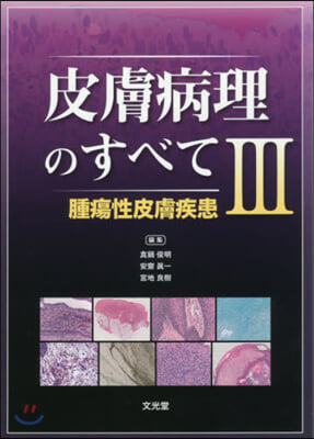 皮膚病理のすべて   3 腫瘍性皮膚疾患