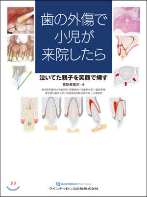 齒の外傷で小兒が來院したら 泣いてた親子