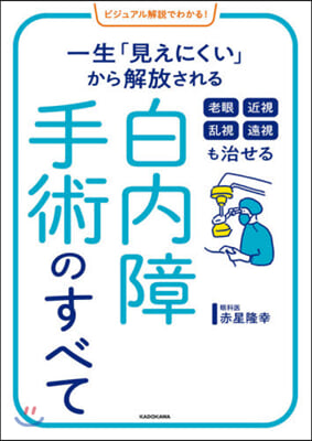 老眼近視亂視遠視も治せる白內障手術のすべ