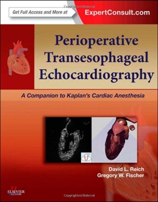 Perioperative Transesophageal Echocardiography