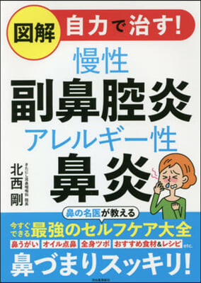 圖解 自力で治す!慢性副鼻腔炎 アレルギ