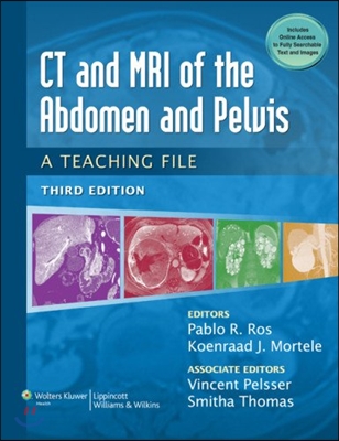 CT &amp; MRI of the Abdomen and Pelvis: A Teaching File