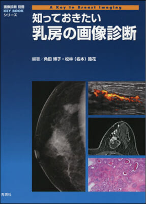 知っておきたい乳房の畵像診斷