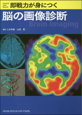 卽戰力が身につく腦の畵像診斷