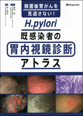 除菌後胃がんを見逃さない! H.pylori旣感染者の胃內視鏡診斷アトラス