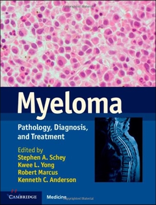 Myeloma: Pathology, Diagnosis, and Treatment