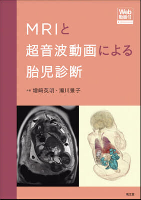 MRIと超音波動畵による胎兒診斷