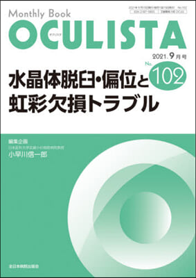 水晶體脫臼.偏位と虹彩欠損トラブル