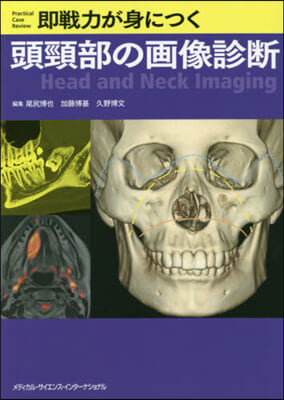 卽戰力が身につく頭頸部の畵像診斷
