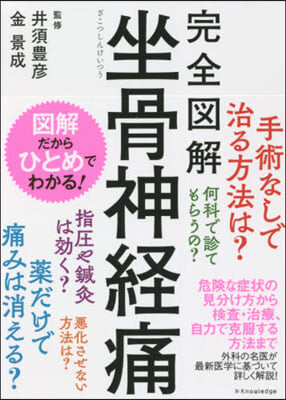 完全圖解 坐骨神經痛