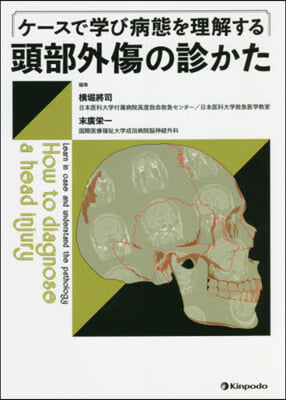 ケ-スで學び病態を理解する 頭部外傷の診