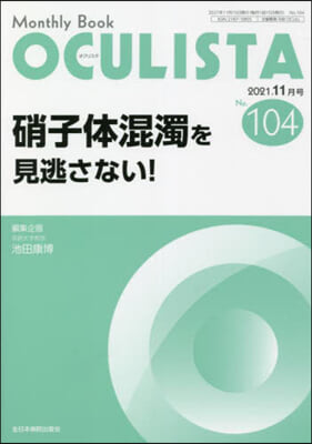 硝子體混濁を見逃さない!