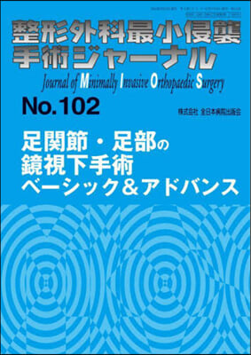 足關節.足部の鏡視下手術ベ-シック&アド