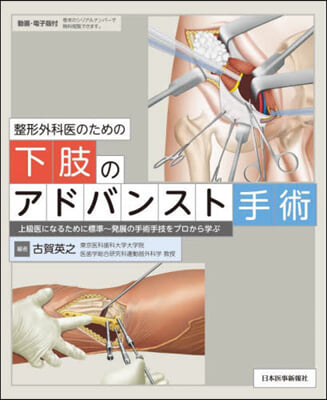 整形外科醫のための下肢のアドバンスト手術