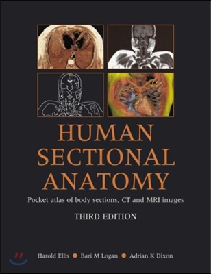 Human Sectional Anatomy Pocket Atlas of Body Sections, Ct and MRI Images