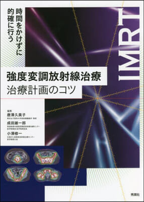 强度變調放射線治療 治療計畵のコツ